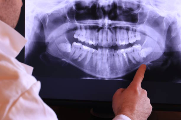 Best Emergency Tooth Extraction in Huntington, UT