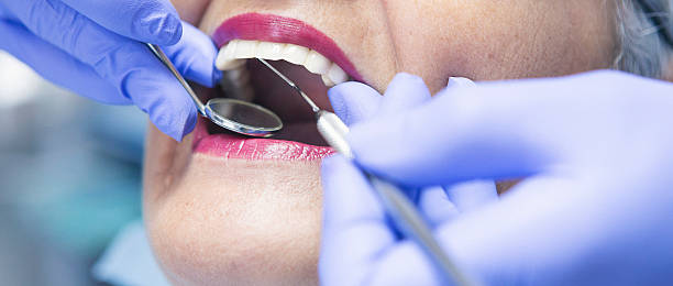 Best Emergency Treatment for Toothache in Huntington, UT